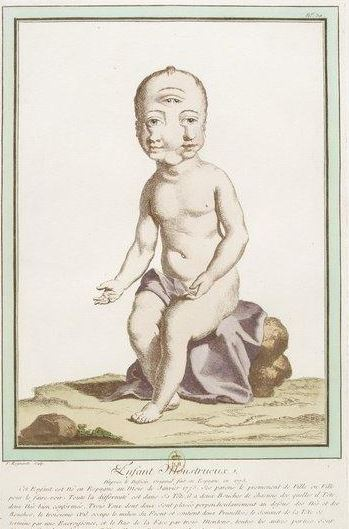 Illustration for article titled Beautiful Portraits of "Monstrosities" from the 18th Century